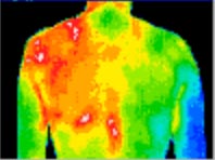 Thermography sample: back thermography