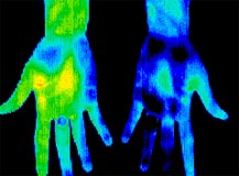 Thermography sample: hand thermography